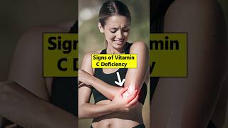 7 Common Signs of Vitamin C Deficiency [upl. by Yxel]