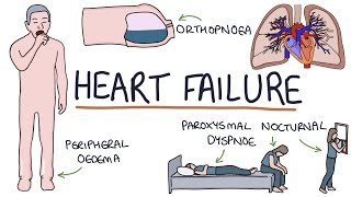 Understanding Heart Failure Visual Explanation for Students [upl. by Ynettirb]