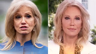 Did Kellyanne Conway Get Plastic Surgery [upl. by Cherilyn]