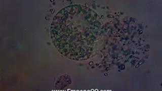 Fresh Water Oodinium cysts crack [upl. by Fernandez]