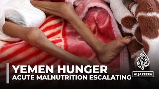 Famine looming in parts of Yemen UN experts warn [upl. by Yablon]