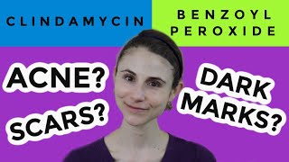 Clindamycin versus benzoyl peroxide for acne Dr Dray [upl. by Swayne371]