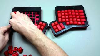 How to Build an Ergodox Assembly 11 [upl. by Amri]