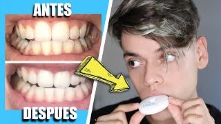 CÓMO BLANQUEAR tus dientes en MINUTOS  BLANQUEADOR DENTAL con LUZ 😬 ¿FUNCIONA [upl. by Cooper]