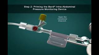 IntraAbdominal Pressure Monitoring [upl. by Clotilde]