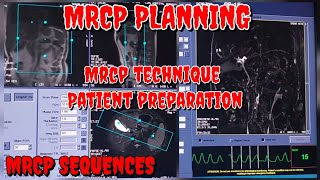 How To Do MRCP  Step by Step Guide to MRCP  MRCP Sequences amp Planning  MRI Upper Abdomen CBD [upl. by Liatnahs]