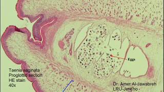 Taenia saginata proglottid cross section [upl. by Lucius]