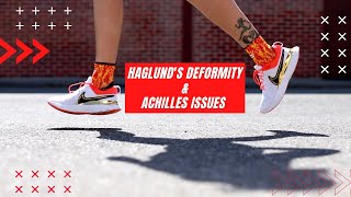 Taping Your Feet For Haglunds Deformity and Achilles Issues You can run without pain [upl. by Aidnyl]