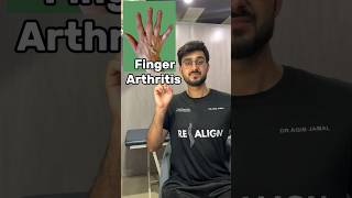 Finger arthritis best excercises ✅ arthritis arthritisrelief fingers rheumatoidarthritis [upl. by Lesnah]