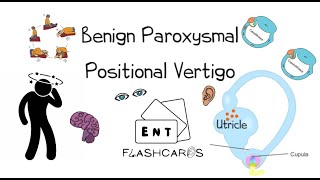 Benign Paroxysmal Positional Vertigo  FRCS ENT Exam Essentials [upl. by Wendy]