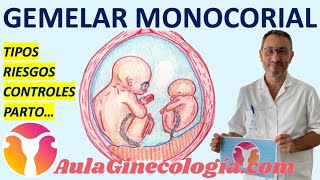 GEMELAR MONOCORIAL TIPOS RIESGOS CONTROLES PARTO COMPLICACIONES  Ginecología y Obstetricia [upl. by Parry]