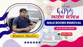 Patients Review on Grade 2 Gynecomastia Surgerydranirbanghosh cosmeticsurgery vasergynecomastia [upl. by Kimball148]