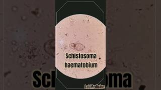 Schistosoma haematobium in urine  Clinical Parasitology [upl. by Reuven]