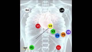 ECG PLACEMENT  12 LEAD ECG [upl. by Kolb]