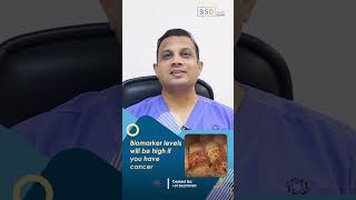 Biomarkers for Ovarian Cancer CA125 Vs HE4 Explained  Ovarian Cancer Diagnosis  Dr Nilesh [upl. by Llebanna]