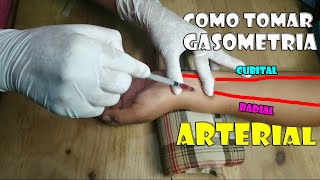 ✅COMO TOMAR UNA GASOMETRIA ARTERIALFÁCIL💉 [upl. by Ecirb311]