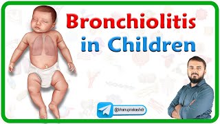 Bronchiolitis in Children  Etiology Clinical features Diagnosis Management and Complications [upl. by Torrance]