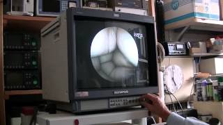 demonstration colonne video Fjinon EPX 201 et EG 200 gastroscope [upl. by Engamrahc]