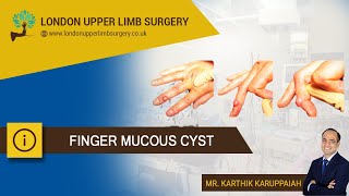 Finger mucous cyst [upl. by Redep]