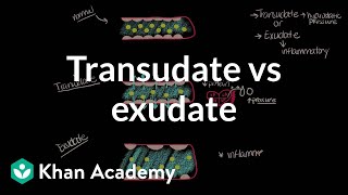 Transudate vs exudate  Respiratory system diseases  NCLEXRN  Khan Academy [upl. by Mallissa420]