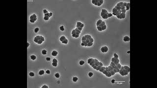 Cholera bacteria can survive antibiotics for a time by turning into globs [upl. by Gratiana]