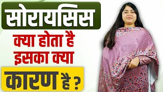 सोरायसिस क्या होता है इसका क्या कारण है   What Is Psoriasis And What Causes It [upl. by Michell274]