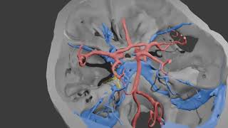 3D Exploration of anomalous venous drainage Relations with the Cavernous Sinus and Trigeminal Nerve [upl. by Aip]