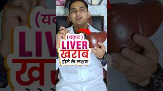 Liver ख़राब होने के क्या क्या लक्षण होते है । Liver cirrhosis  fatty liver viral shorts [upl. by Anaiad]