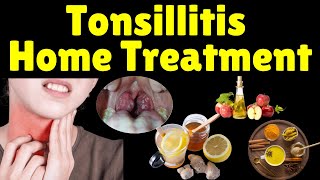 Tonsillitis Home Treatment  Tonsillitis Home Remedies  How to Treat Tonsillitis at Home [upl. by Sonnie955]