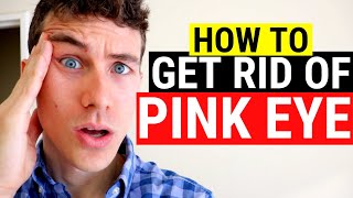 🔴 How to Get Rid of Pink Eye  3 Must Know Facts About Pink Eye and Conjunctivitis [upl. by Ayikahs]