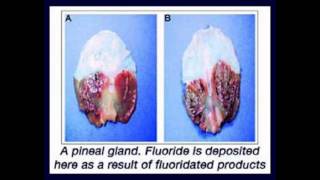 Las Verdaderas Consecuencias Del Flúor En Nuestro Organismo [upl. by Ariaic641]