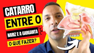 COMO ELIMINAR O CATARRO QUE FICA ENTRE O NARIZ E A GARGANTA [upl. by Ielerol]