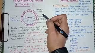 Thrombosis Part 2  Definition Causes Types Morphology amp Pathology [upl. by Luanne]