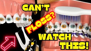 How to BRUSH and FLOSS your TEETH with BRACES ON  TUTORIAL   BRUSHING  FLOSSING [upl. by Otanod]