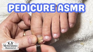 👣ASMR Pedicure Cleaning💆‍♀️Toenail Recovery Pedicure Tutorial👣 [upl. by Moriah719]