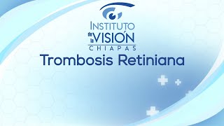 Trombosis retiniana [upl. by Saile]