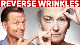 How To Reverse Wrinkles  – DrBerg on Anti Aging Hormones [upl. by Newfeld]