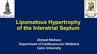 Lipomatous hypertrophy of the Interatrial Septum Lipomatous atrial septal hypertrophy LASH [upl. by Oinoitna534]