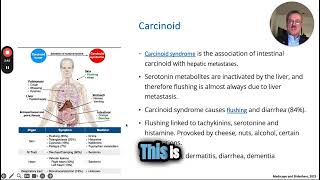 Understanding Carcinoid Syndrome in Gastrointestinal Cases [upl. by Newsom]