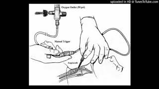 Percutaneous Transtracheal Jet Ventilation Trachea [upl. by Tirzah]