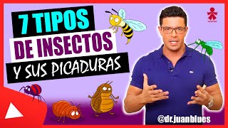 TIPOS DE PICADURA ‼️ INSECTO RESPONSABLE ‼️ CÓMO RECONOCERLO ⁉️ 🐜 🪲🪰🦗🦟🐞🪳🕷 [upl. by Karli919]