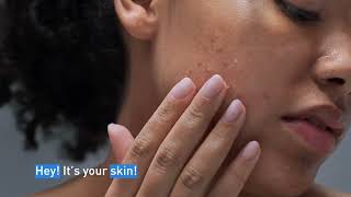 Clear Acne and Prevent New Breakouts │ CeraVe Skincare [upl. by Sholom]