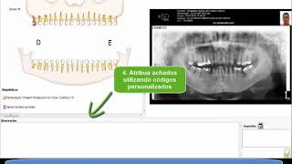 Easy Print  Documentações para Radiologia Odontológica  Anne Solutions [upl. by Andreana]