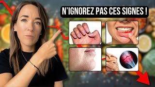 CES 11 SIGNES montrent que votre CORPS MANQUE DE NUTRIMENTS ESSENTIELS naturopathie [upl. by Froemming819]