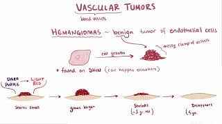 Glomus Tumor  Osmosis [upl. by Ebba262]