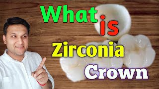 What is Zirconia Crown   Cost of zirconia crown  How long Zirconia crown work [upl. by Neira]