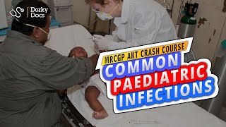 Crash Course Common Paediatric Infections  The MRCGP AKT Exam Revision I Dorky Docs [upl. by Berkow]