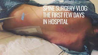 SPINE SURGERY VLOG the first few days in the hospital  rarebonesx [upl. by Reivad384]