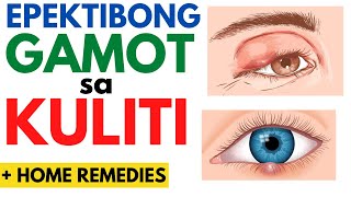 👀 GAMOT sa KULITI  Paano gumaling ang KULITI o BUTLIG sa MATA  Home Remedies Sintomas  Eye Sty [upl. by Leesen]