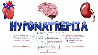 An Approach to Hyponatremia  Hyponatremia Diagnostic Algorithm  Hyponatremia Causes MADE EASY [upl. by Rhiamon]